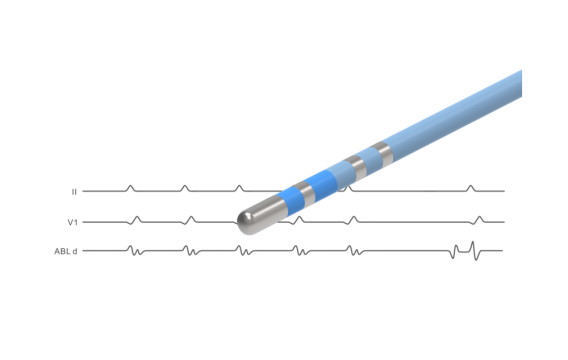 NAVABLATOR? 心臟<font color=red>射頻消融導(dǎo)管</font>