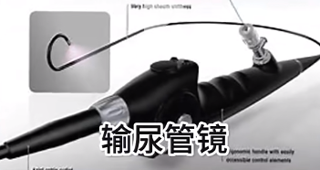 尿道鏡檢查怎么做？尿道鏡檢查的具體操作步驟