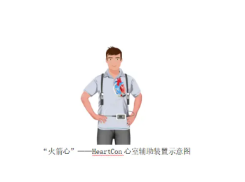 了解心臟體外輔助裝置（ECMO）的原理、應用、優(yōu)勢