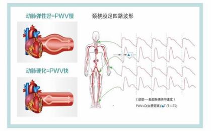 動(dòng)脈硬化檢測(cè)儀：品牌推薦與選購(gòu)指南