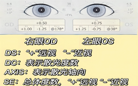 視力篩查儀 06-18-2025